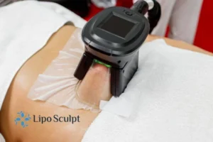 Are The Results From Aqualyx Permanent? 4 Compare Aqualyx Wheathampstead to other fat reduction treatments.