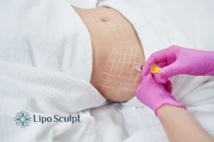 Are The Results From Aqualyx Permanent? 1 Do you want to know how long Aqualyx Wheathampstead results last?